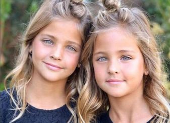2010年に生まれた双子の姉妹は、世界で最も美しい双子に成長しました